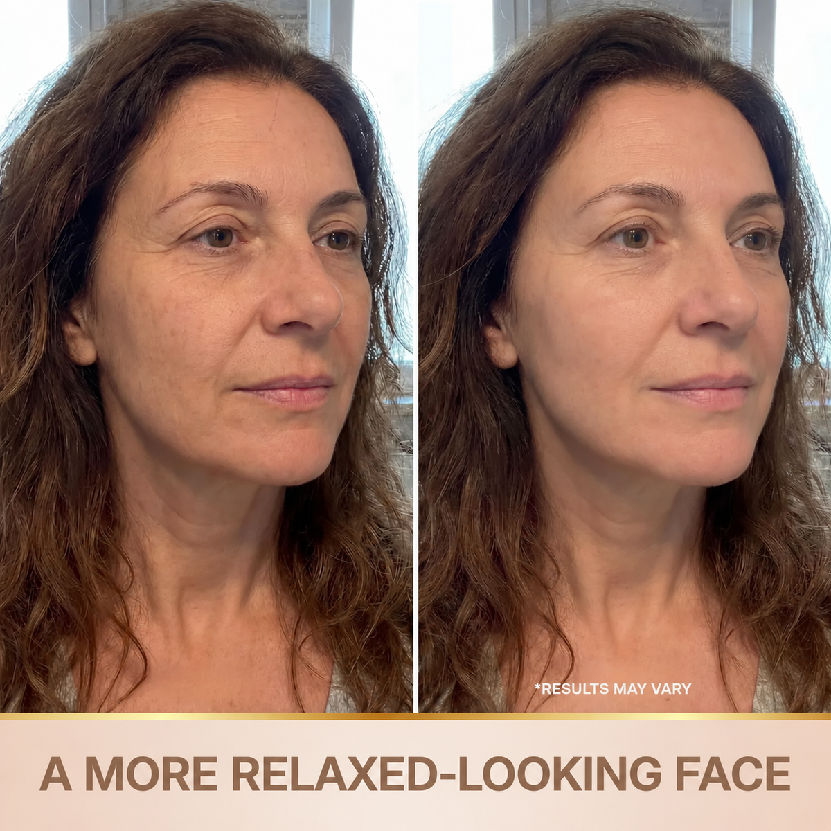 Vyralla – Korean Lifting-Effect Serum from the First Application